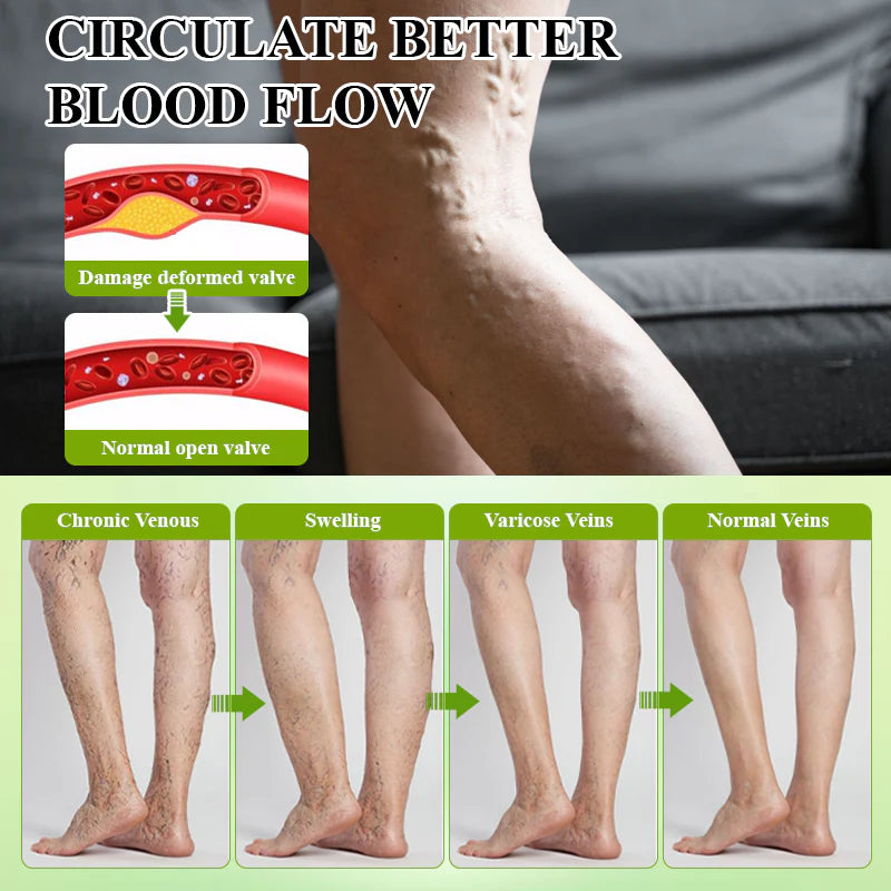 Oveallgo® CircuPro Edema & Lymphatic Support Inhaler 33 ATTDX Fluid Regulation Edema Care Cream abi09 1